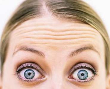 Göz Çevresi Ve Alın Kırışıklıkları