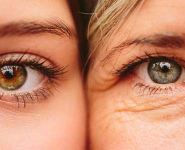 Göz Altı Torbaları