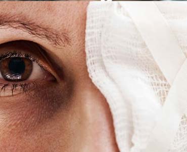 Orbita Yaralanmaları ve Kırıkları